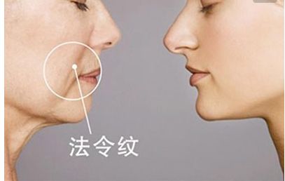長沙田毅雙眼皮手術(shù)新穎獨特，引領(lǐng)2023最新潮流