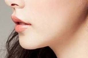 2023天津雙眼皮修復(fù)：醫(yī)生排名與技術(shù)對比，袁強、衛(wèi)星、李小兵等人誰更優(yōu)秀？