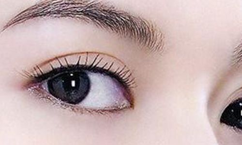 太玲美眸重現(xiàn)！揭秘雙眼皮新趨勢(shì)，驚艷效果讓人眼前一亮