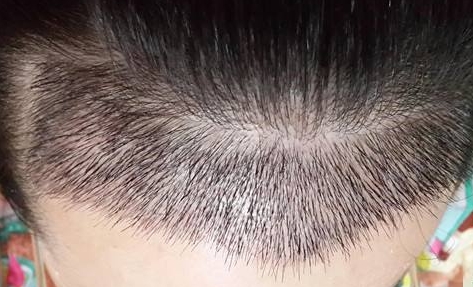 看看這八家贛州整形醫(yī)院有沒(méi)有靠譜的？你知道嗎？