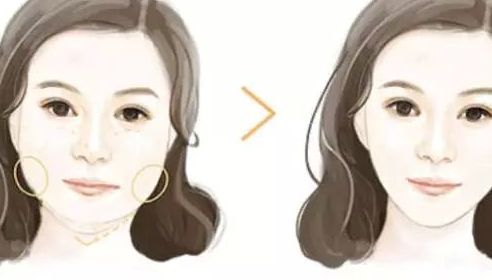 北京哪家整形醫(yī)院的隆鼻效果好？排行榜公開！