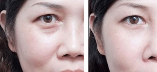 富陽區(qū)去疤整形哪家醫(yī)院口碑好？排行榜前六大推薦！醫(yī)術實力分享值得借鑒