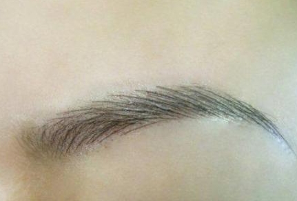 珠海美南華整形醫(yī)院醫(yī)生技術如何？他們擅長哪些項目？