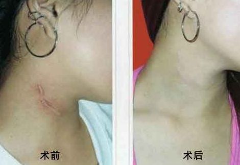 重慶乳房整形六大權(quán)威醫(yī)生盤點(diǎn)，高素質(zhì)專家排行曝光