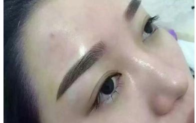 山西二院整形科的醫(yī)生名單更新及熱門項(xiàng)目價(jià)格表分享 山西二院整形科的醫(yī)生名單更新及熱門項(xiàng)目價(jià)格表分享