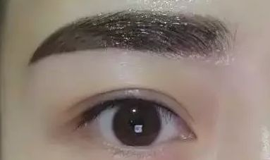上海瑞格整形醫(yī)院領(lǐng)銜醫(yī)師羅瀾濤——重塑美麗眼睛的魔法使者，成功案例揭秘！
