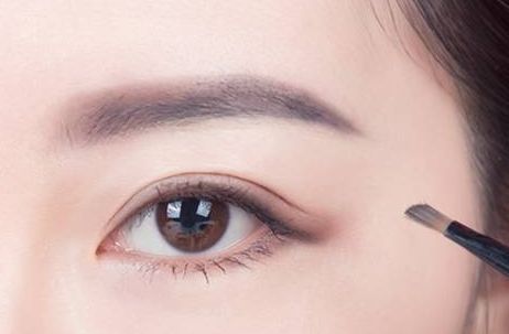 蜜月時光，揭秘黃筱琳醫(yī)生傾情打造的上海九院雙眼皮！2023年最新案例給你參考！