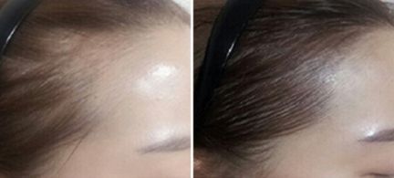 鄭州芳藝醫(yī)療整形醫(yī)院有沒(méi)有特色項(xiàng)目？如何一鍵獲??？