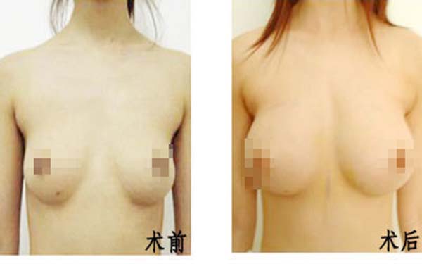 遂寧伊莎貝拉醫(yī)學(xué)美容門(mén)診部醫(yī)生是否值得信賴(lài)？他們的專(zhuān)業(yè)素質(zhì)如何？