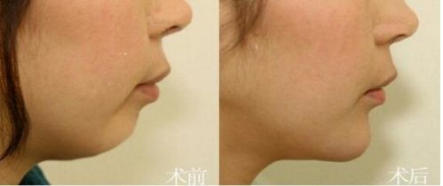 北京市前十名正頜醫(yī)院推薦：八處，協(xié)和，聯(lián)合麗格等，專業(yè)可靠！