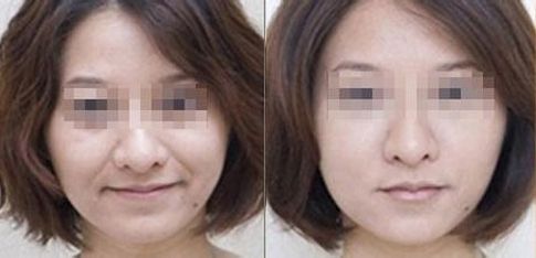 成都有哪些專業(yè)的雙眼皮整形醫(yī)生值得推薦？
