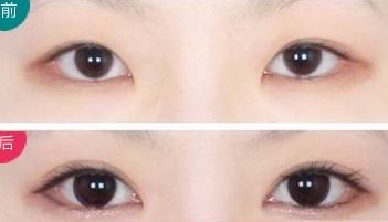 上海最受好評的乳房整形醫(yī)生推薦！超多病人贊賞王濤、何金光！
