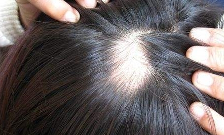 深圳藝星整形醫(yī)院口碑如何？哪位醫(yī)生技術(shù)出眾？收費(fèi)明細(xì)怎么樣？