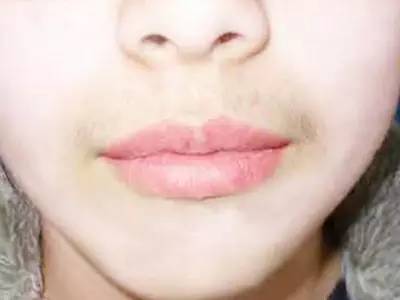 無錫三院整形科哪位醫(yī)生會更受關(guān)注？