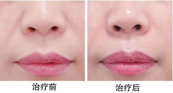 最靠譜的蘇州下頜角整形醫(yī)院推薦，口碑爆棚的醫(yī)療機構評選