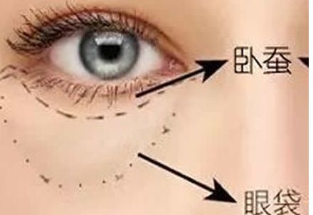 北京協(xié)和醫(yī)院隆胸案例與醫(yī)生簡介含金量如何？收費是否合理？