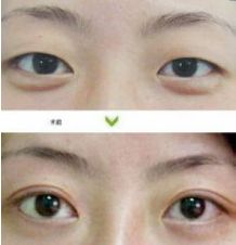 成都哪些醫(yī)生能力出眾進行隆胸術？年度隆胸好醫(yī)生十大排名出爐