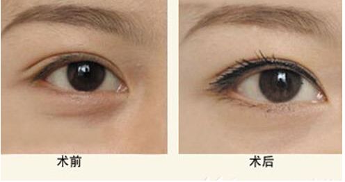 【獨(dú)家】上海九院整形科醫(yī)生王琛醫(yī)生的專(zhuān)長(zhǎng)與案例分享 【獨(dú)家】上海九院整形科醫(yī)生王琛醫(yī)生的專(zhuān)長(zhǎng)與案例分享