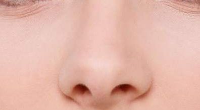 泉州哪家醫(yī)院在脂肪填充整形領(lǐng)域有口碑？重新認識久負盛名的歐菲整形