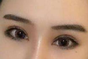 成都大華整形醫(yī)院醫(yī)生有哪些擅長項目？醫(yī)院技術(shù)如何？