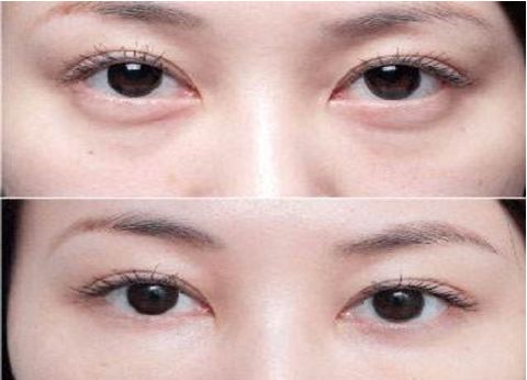 杭州專業(yè)整容醫(yī)療機構(gòu)排行榜大揭秘！藝術(shù)之星醫(yī)療集團對比時光整形大賽！真實原因還原無遺！