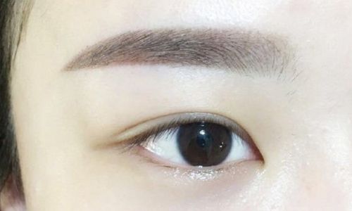 袁斯明醫(yī)生手術(shù)等待時間？術(shù)后恢復(fù)效果如何？眼部整容40天現(xiàn)圖曝光！