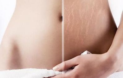 浙江知名隆胸醫(yī)院推薦！這些醫(yī)院廣受好評(píng)