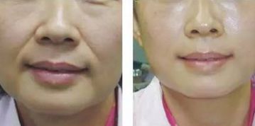 青島鼻修復(fù)：頂級專家實力享譽！唇齒相依的實力推薦
