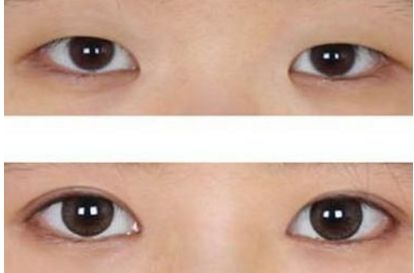 哪家整形醫(yī)院是濟(jì)南市最受信賴的？三大醫(yī)療機(jī)構(gòu)曝光！