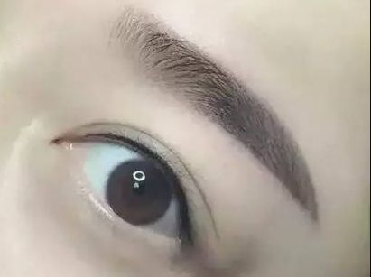 護眼實踐：林琦東如何改善視力？真實案例揭示眼部整形費用