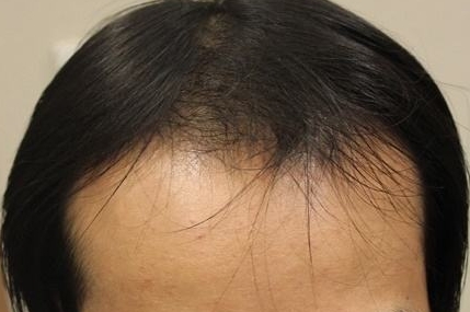 山西省人民醫(yī)院美容科是不是掛號(hào)很難？有哪些就醫(yī)經(jīng)驗(yàn)值得分享？