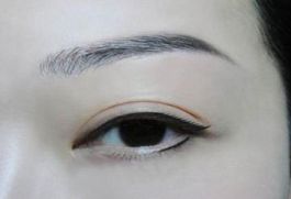 深圳著名眼袋整形專家?guī)湍獯穑i程醫(yī)院是否值得選擇？