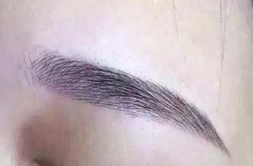 長沙脂肪吸取專家揭秘：技術(shù)卓越，無數(shù)口碑背后的醫(yī)美奇跡！