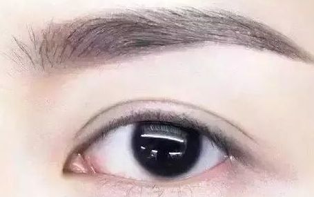 全國哪位專家值得信賴修復雙眼皮手術(shù)？頂級醫(yī)生排行榜首推名單揭曉