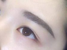 李炳澮醫(yī)生獨(dú)特的技術(shù) 手術(shù)風(fēng)格有何特點(diǎn)？并附帶隆鼻案例分析
