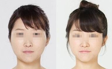 廣州哪家醫(yī)院能夠有效除皺？詳細(xì)介紹醫(yī)院基本情況分享