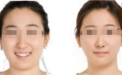 鄭州哪位醫(yī)生在鼻整形領域赫赫有名？口碑出類拔萃的五位專家揭曉！