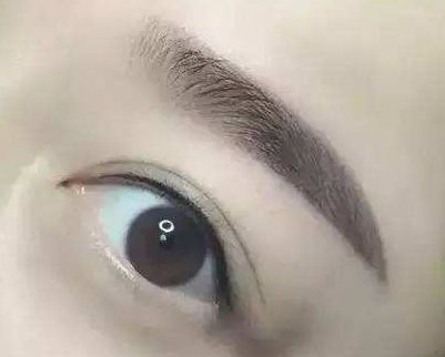 廈門哪家整形醫(yī)院口碑好？專家推薦薇格、中山前三！