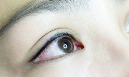 合肥最新星之地整形技術效果如何？魅力煥新，領略面部脂肪填充成功案例