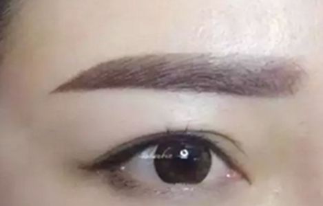 南昌美伊爾醫(yī)院的劉立軍醫(yī)生手術(shù)實(shí)力如何？擅長(zhǎng)哪些手術(shù)？附真實(shí)案例為參考