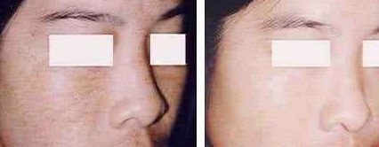 福州美貝爾醫(yī)療美容門診部：薛欣醫(yī)生用戶評價高？真實案例分享！