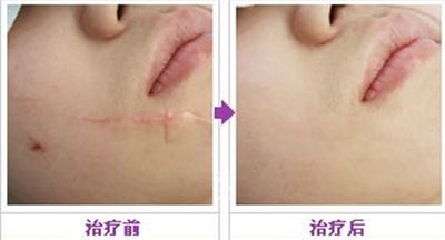 廣州做吸脂手術哪家醫(yī)院效果好？這幾家技術領先