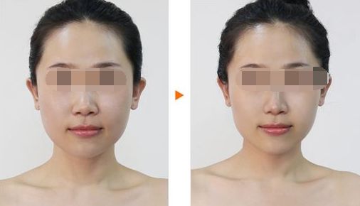 廣州哪家整形醫(yī)院好？排名前十值得推薦