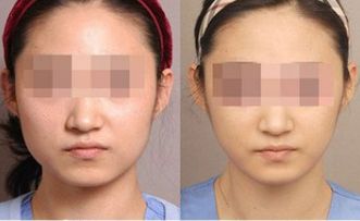 湛江有哪些頂尖整形美容醫(yī)院值得關(guān)注？