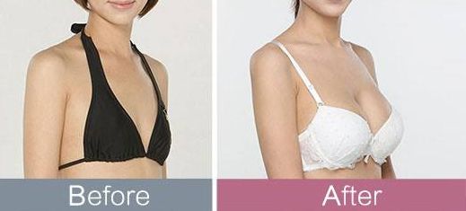 東莞哪家整形醫(yī)院頗受推薦？
