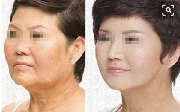揭秘鄭州鼻修復(fù)名家，一覽權(quán)威醫(yī)生陣容