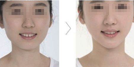 哪家醫(yī)院在北京具有卓越的醫(yī)美科技和服務(wù)？歐洲醫(yī)學(xué)中心、北京協(xié)和、北大人民醫(yī)院等公立單位有何特色？
