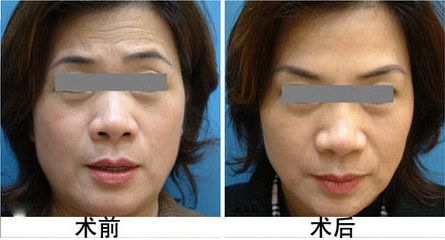 成都哪些醫(yī)院提供私密整形服務(wù)