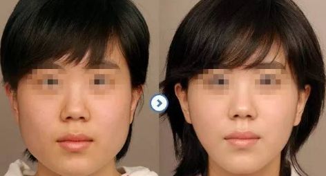 【揭秘】合肥私立整形醫(yī)院人氣TOP榜單！