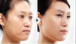 上海頂尖美容整形醫(yī)院精選，讓你真正了解排行榜